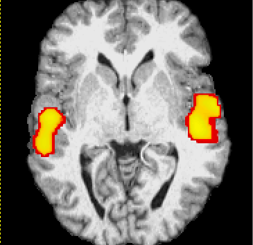 MRI scan in Chembur, Mumbai