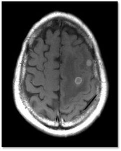 MRI scan in Chembur