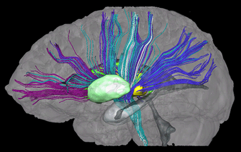 MRI scan in Mumbai