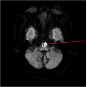 MRI scan in Mumbai