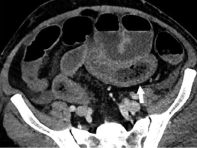 Gastrointestinal-imaging-fig-A
