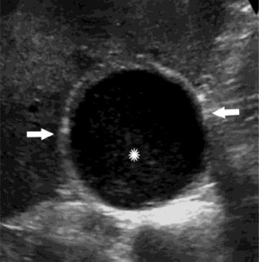 Gastrointestinal-imaging-fig-B