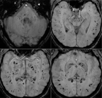 Neuroimaging-fig-A