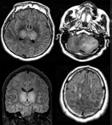 Neuroimaging-fig-B