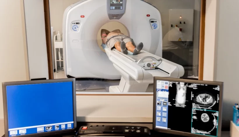 Top 5 Myths About MRI Scans
